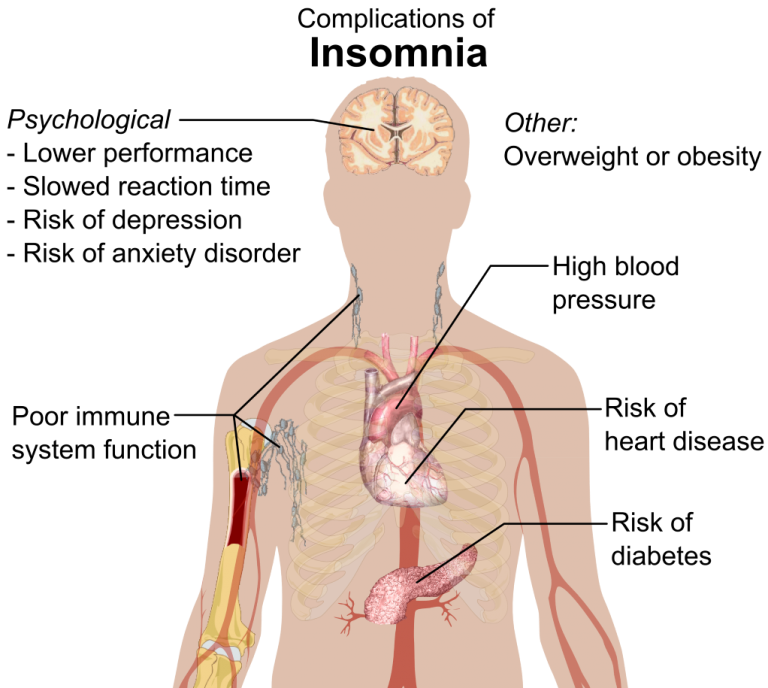 Chronic Insomnia Symptoms : Insomnia: What It Is, Causes, Symptoms ...